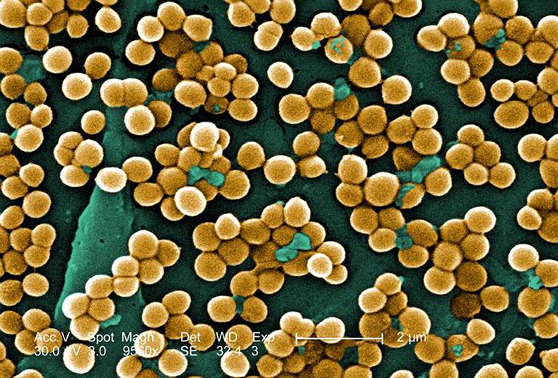 Scientists are engineering good bugs to defeat deadly bacteria such as these clusters of the notorious MRSA (Methicillin-resistant Staphylococcus aureus) strain, here magnified 9,560 times. MRSA resists treatment by almost all stardard anti-biotics. (Janice Haney Carr/CDD/Tribune News Service)