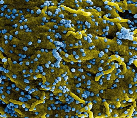 Genetic structure of the respiratory disease affecting China and its residents; Coronavirus.